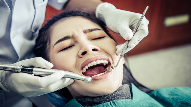 Dental Fillings